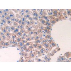 Interleukin 17 Receptor E (IL17RE) Antibody