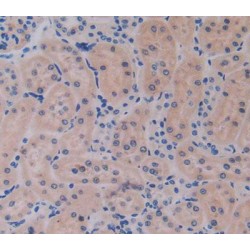 Interleukin 17 Receptor E (IL17RE) Antibody