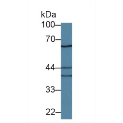 Interleukin 18 Receptor 1 (IL18R1) Antibody
