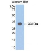 Western blot analysis of recombinant Human IL31RA.