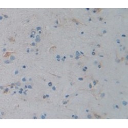 Lipase, Bile Salt Dependent (BSDL) Antibody