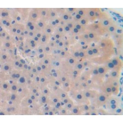 C-C Motif Chemokine 22 (CCL22) Antibody