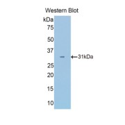 Western blot analysis of the recombinant protein.