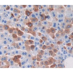 Pyruvate Dehydrogenase Beta (PDHb) Antibody