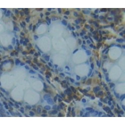 Ribonuclease III, Nuclear (RNASEN) Antibody