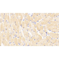 Troponin I, Cardiac Muscle (TNNI3) Antibody