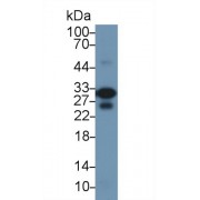 Western blot analysis of Mouse Heart lysate, using Rat TNNI3 Antibody (1 µg/ml) and HRP-conjugated Goat Anti-Rabbit antibody (<a href="https://www.abbexa.com/index.php?route=product/search&amp;search=abx400043" target="_blank">abx400043</a>, 0.2 µg/ml).