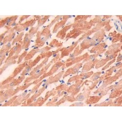 Troponin I, Cardiac Muscle (TNNI3) Antibody