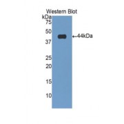 Western blot analysis of the recombinant protein.