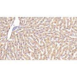 Tumor Necrosis Factor (TNF) Antibody