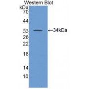 Western blot analysis of recombinant Human ALOX5.