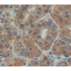 Aspartate Aminotransferase, Mitochondrial / AST (GOT2) Antibody
