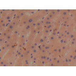 Bone Morphogenetic Protein 1 (BMP1) Antibody