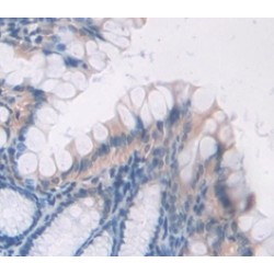 Bone Morphogenetic Protein 2 (BMP2) Antibody