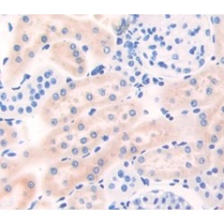 Bone Morphogenetic Protein 2 (BMP2) Antibody