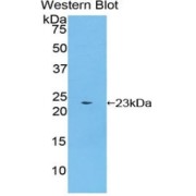 Western blot analysis of the recombinant protein.