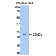 Western blot analysis of the recombinant protein.