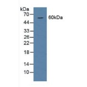 Western blot analysis of Rat Serum.