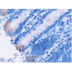 Bone Morphogenetic Protein 6 (BMP6) Antibody
