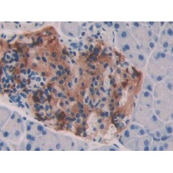 Bone Morphogenetic Protein 7 (BMP7) Antibody