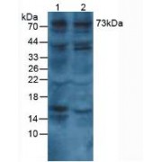 Western blot analysis of (1) Human Lung Tissue and (2) Human Hepg2 Cells.