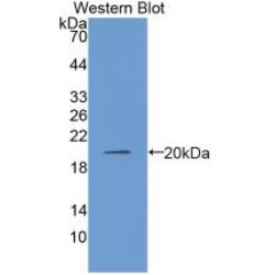 Collagen Type VIII Alpha 1 (COL8A1) Antibody