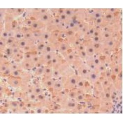 Collagen Type VIII Alpha 1 (COL8A1) Antibody