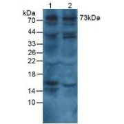 WB analysis of Human lung tissue (lane 1) and HepG2 cells (lane 2) using Collagen Alpha-1 VIII Chain (COL8A1) Antibody.