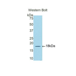 Debranching Enzyme Homolog 1 (DBR1) Antibody