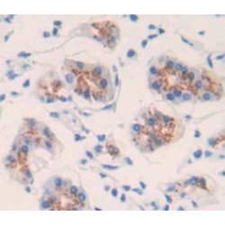 Debranching Enzyme Homolog 1 (DBR1) Antibody