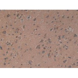 Delta Sleep-Inducing Peptide (dSIP) Antibody