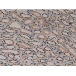 Delta Sleep-Inducing Peptide (dSIP) Antibody