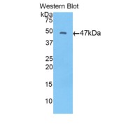 Western blot analysis of the recombinant protein.