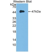 Western blot analysis of the recombinant protein.