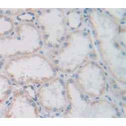 Fibroblast Growth Factor 13 (FGF13) Antibody