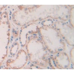 Fibroblast Growth Factor 13 (FGF13) Antibody