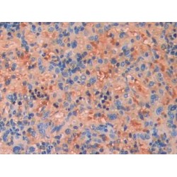 Fibroblast Growth Factor 13 (FGF13) Antibody
