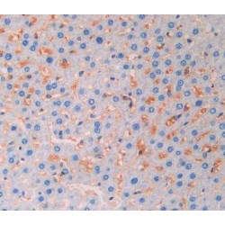 Fibroblast Growth Factor 13 (FGF13) Antibody