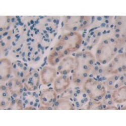 Fibroblast Growth Factor 19 (FGF19) Antibody