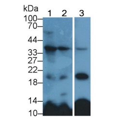 Fibroblast Growth Factor 23 (FGF23) Antibody