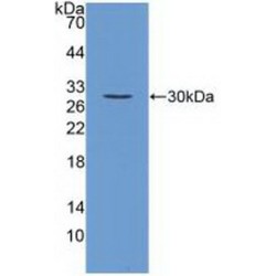 Fibroblast Growth Factor 23 (FGF23) Antibody