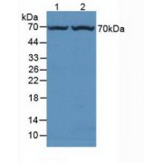 Western blot analysis of (1) Rat Liver Tissue and (2) Mouse Liver Tissue.