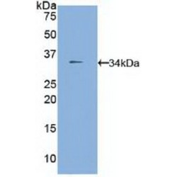 Tissue Alpha-L-Fucosidase (FUCA1) Antibody
