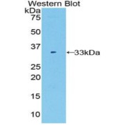 Western blot analysis of the recombinant protein.