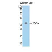 Western blot analysis of the recombinant protein.