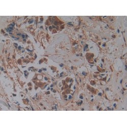 Glia Maturation Factor Gamma (GMFg) Antibody