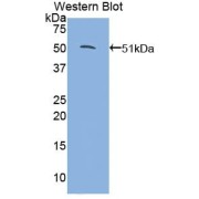 Western blot analysis of the recombinant protein.