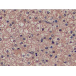 Glutathione S-Transferase P (GSTP1) Antibody