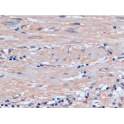 Glutathione S-Transferase P (GSTP1) Antibody