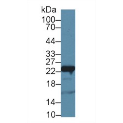 Glutathione S-Transferase P (GSTP1) Antibody
